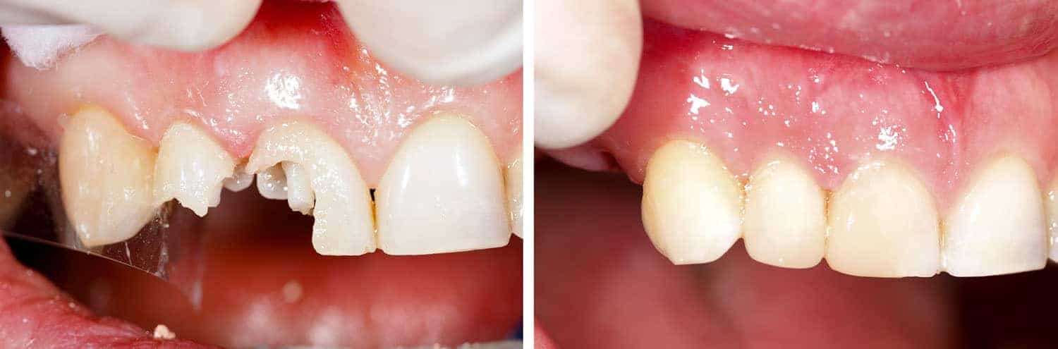 Casi clinici Dentalblu